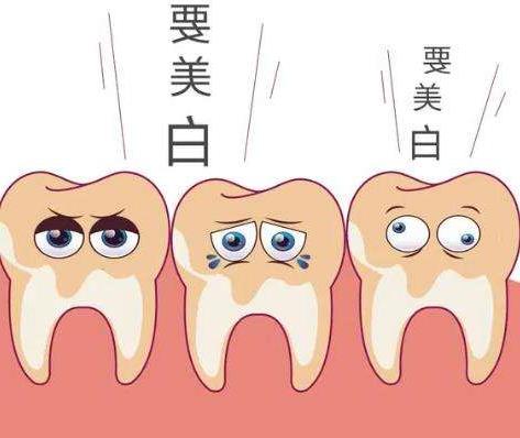 合肥地包天矫正：牙套治疗全攻略及费用解析(图1)