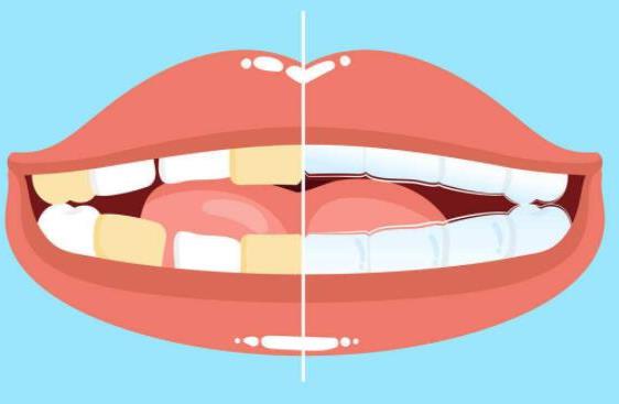合肥健雅口腔种植牙服务解析:技术革新与价格优势(图2)