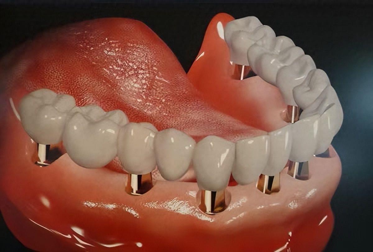 湖北科技学院口腔医院全新收费标准:种牙、矫正、全瓷牙价格一览(图1)