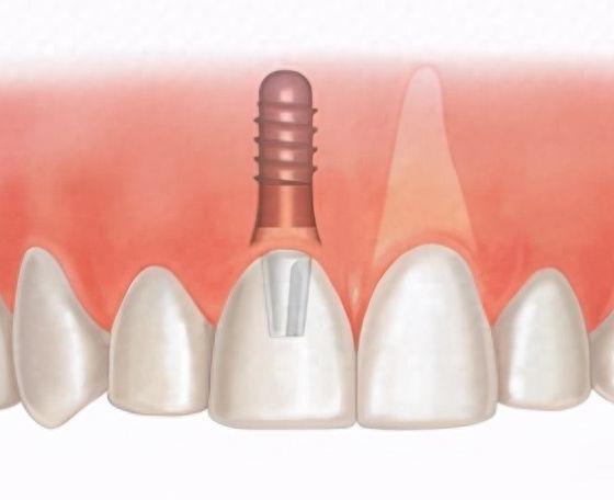 成都唐牙科医院评价：服务、技术与价格全解析