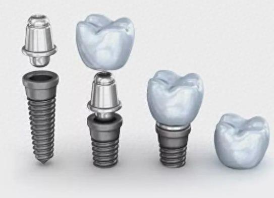 常州华釾口腔医院价格全解析:牙齿矫正、种植及修复服务费用一览(图1)