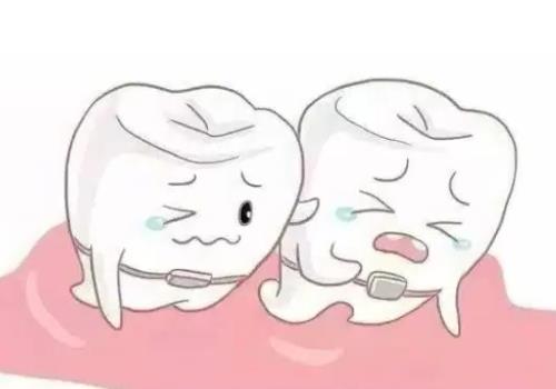 广州牙齿种植医院哪家强?穗华、广大、中家医三家医院大比拼(图2)