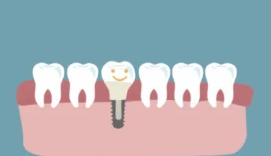 呼和浩特种植牙医院排名:技术与服务的卓越之选(图1)