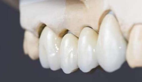 中诺口腔医院全新收费标准发布，种植牙价格极具竞争力