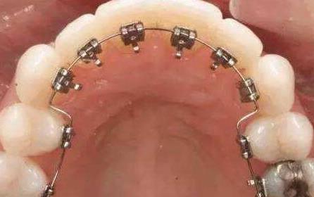 海口国雅口腔医院评测:服务、价格与效果深度解析(图1)