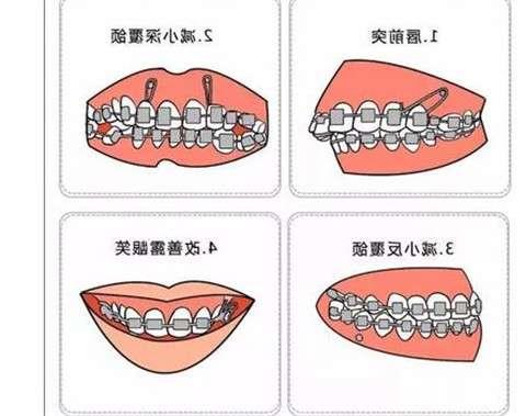 徐州鼎植口腔医院全新价格表解读及服务特色一览(图1)