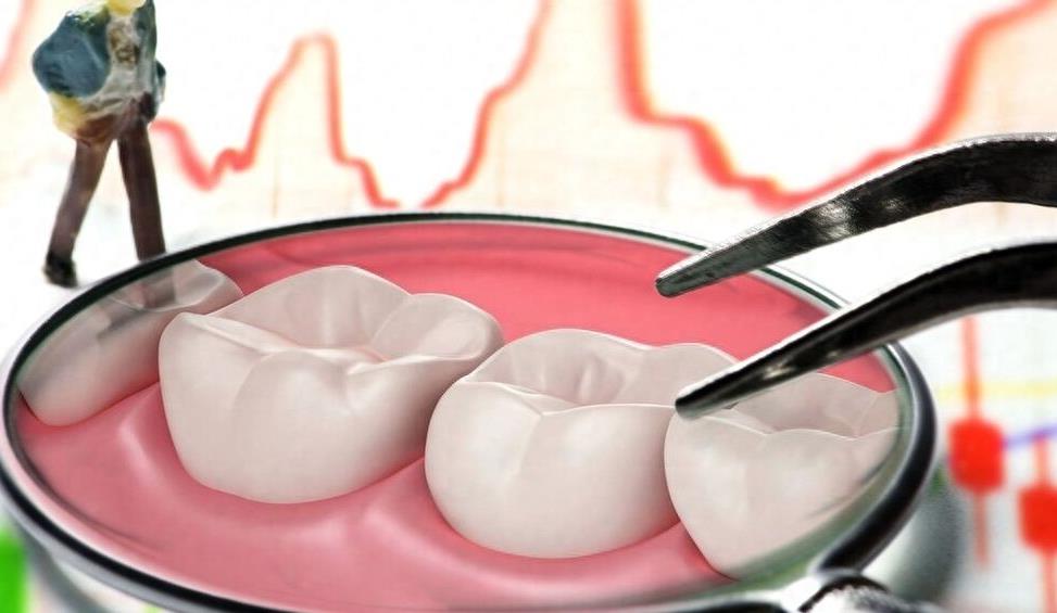 大连牙齿修复:镶牙材料选择与价格全解析(图1)