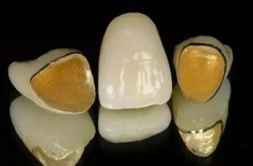 郴州植贝尔口腔诊所评测：亲民价格与专业服务的好结合(图1)