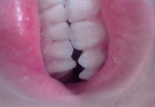 汉中市口腔医院矫正牙齿服务与价格全攻略(图1)