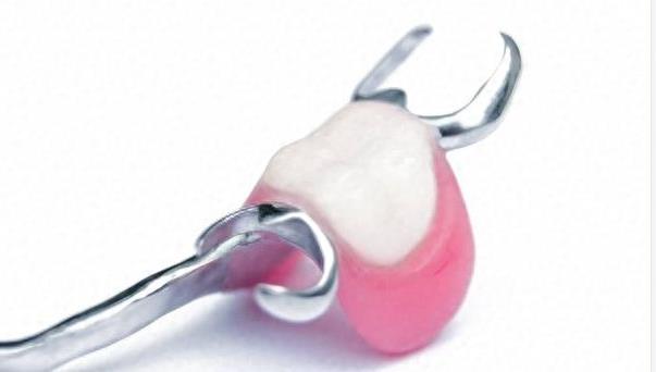 成都极光口腔牙齿矫正全攻略:价格、技术与个性化方案解析(图1)