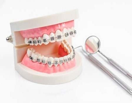 南宁蓝钻口腔服务价格全解析:看牙费用大公开(图2)