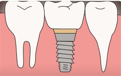 合肥佳冠口腔牙齿矫正服务解析:技术先进,团队专业,价格亲民(图1)