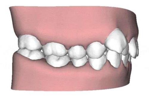 海口鼎点口腔医院:解析其亲民价格与优质服务(图2)