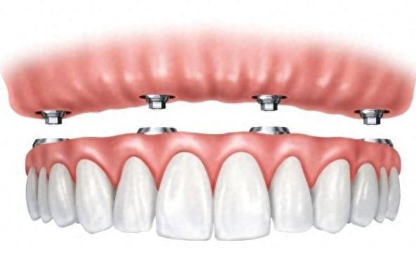 大冶咿呀口腔诊所价格指南及服务介绍(图1)