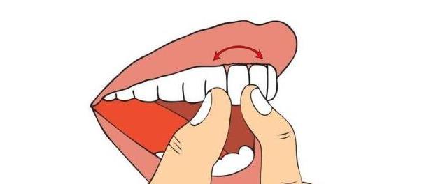 阿克苏种植牙推荐:三家医院的深度解析与患者评价(图1)