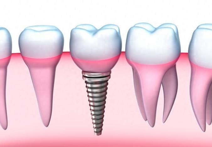南京牙科正畸医院排名及特色服务介绍(图2)