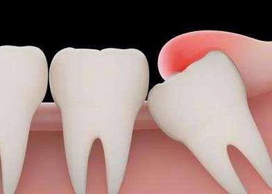 广州口腔医院种植牙服务排名,寻找性价比高的种牙医院(图1)