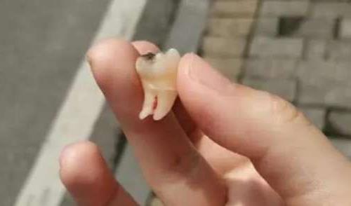 合肥牙科诊所深度测评:三家值得信赖的种植牙服务推荐(图1)