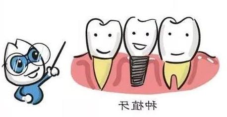 儿童牙齿矫正器价格全解析及选择指南(图1)