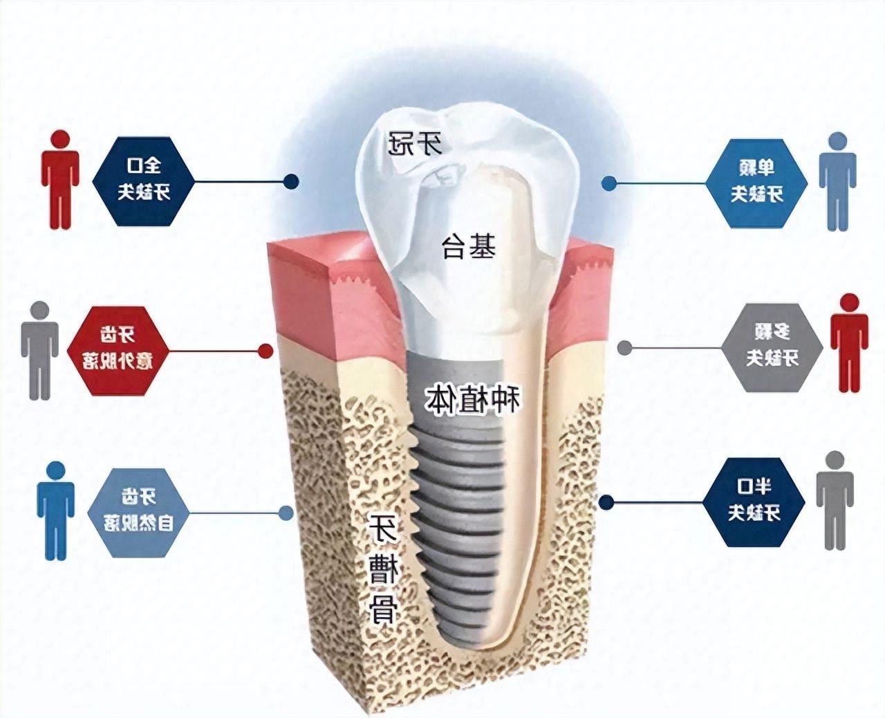临汾麦特登口腔隐形矫正:技术精湛,服务周到,价格亲民(图2)