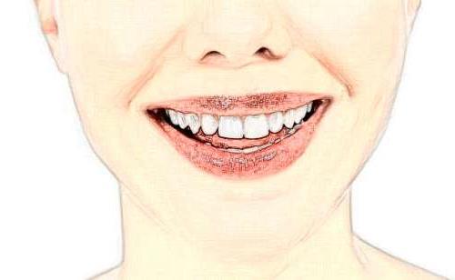 海南微笑口腔连锁品牌深度解析:口碑、服务与价格(图2)