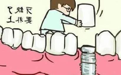 彭埠区种植牙医院推荐:性价比与正规性并重(图1)