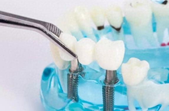 北京儿童口腔医院推荐:朝阳公园旁的整齐娃娃口腔,劲松集团的儿童口腔健康守护者(图1)