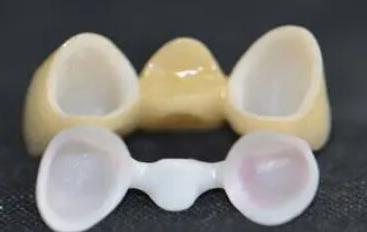 种植牙费用分析:技术革新与市场竞争下的定价趋势(图1)