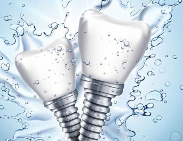 哈尔滨种植牙费用全解析:不同品牌价格一览(图1)