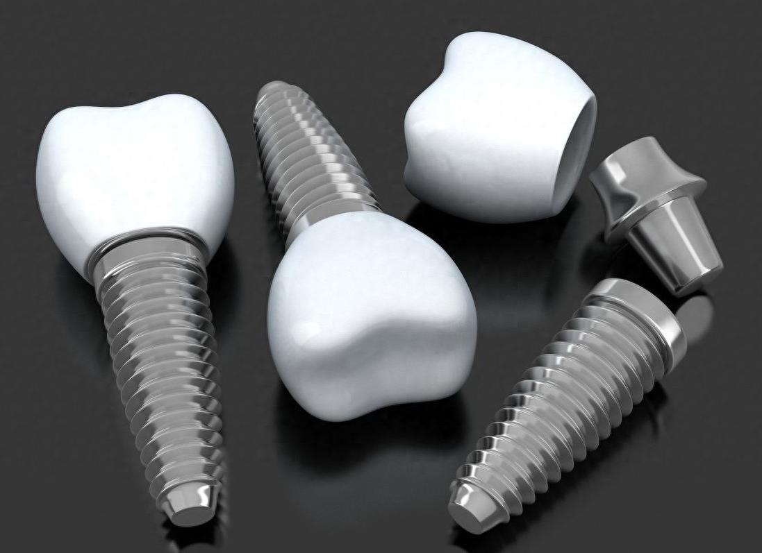 北京口腔医院种植牙服务排名，十家牙科诊所引领行业新标准(图2)