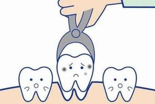 西安兔博士口腔种植牙价格全解析，种牙费用一览表(图1)