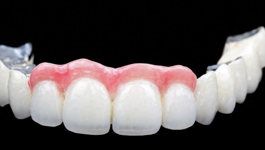 大冶华玉口腔诊疗服务价格全解析,省钱攻略大公开(图1)