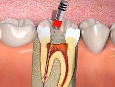 济南种植牙医院推荐及价格指南