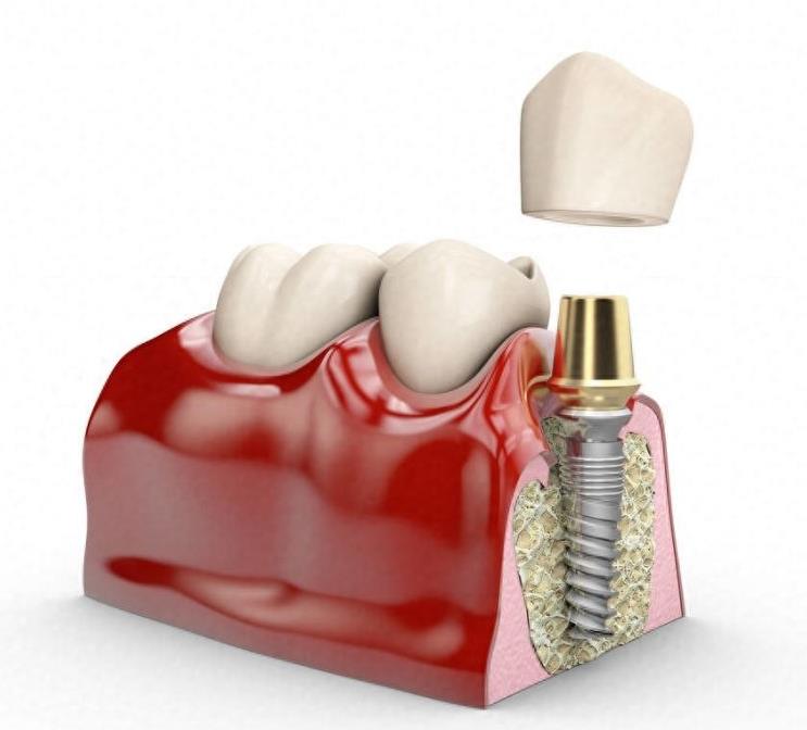 深圳正夫口腔正畸中心:专业服务与优惠价格的好融合(图2)