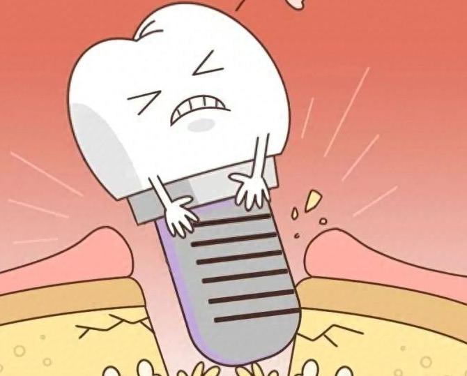 绵阳种植牙医院推荐：技术、价格与服务的评估(图2)