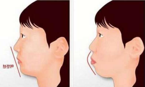 南京牙齿矫正医院大比拼:专业服务与价格全解析(图1)