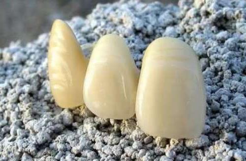 德韩口腔全新种植牙价格指南,涵盖五大城市分院详细费用一览(图1)