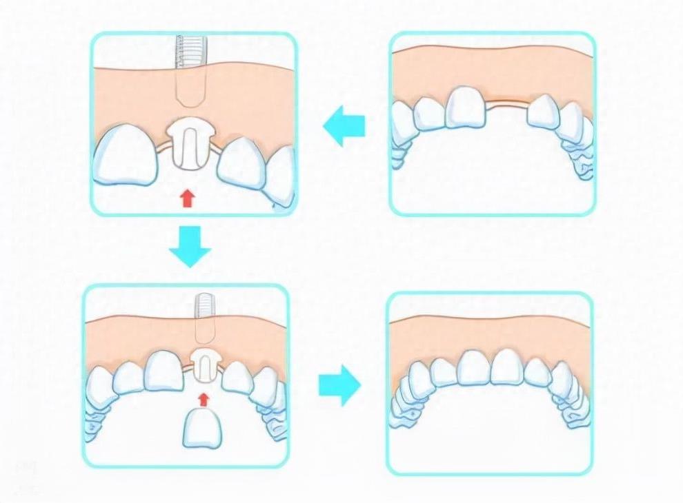 合肥爱乐雅口腔治疗费用解析：口腔医疗服务价格全览