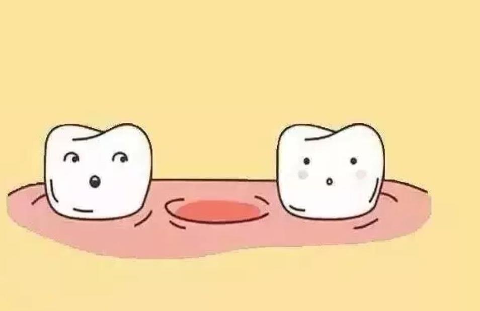 烟台牙齿矫正费用全解析:价格差异与选择指南(图1)