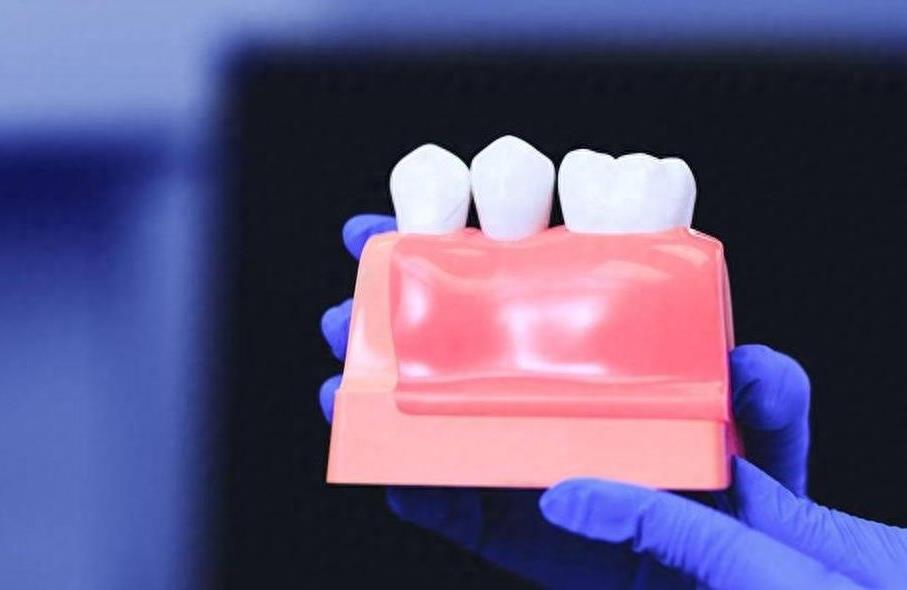 福州深龋齿修复全攻略:价格解析与材料选择指南(图2)