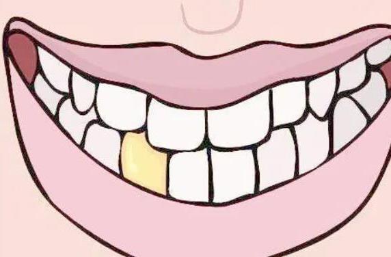 佛山爱顿口腔医院全新价格表发布,涵盖种植牙、矫正等项目(图1)