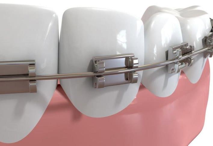 运城嘉悦口腔医院即拔即种技术解析及价格指南(图1)