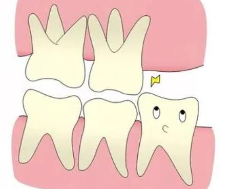 种植牙费用新标准解读:了解种植成本结构(图2)