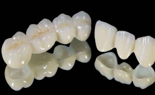 佛山春芽口腔种植牙价格分析与技术概览