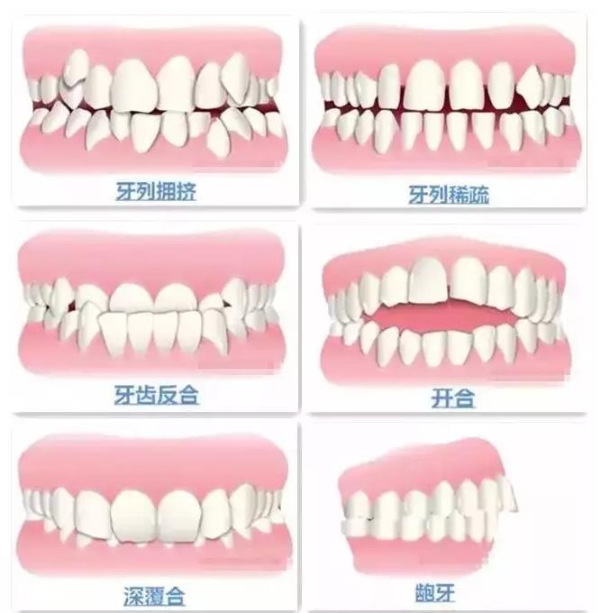 清远牙齿矫正医院推荐:专业医师与合理价格的好结合(图1)
