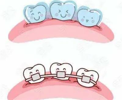 宁德市隐形牙套矫正：价格全解析及优质医院推荐