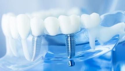 襄阳口腔医院全新价格表发布,涵盖洗牙、拔牙、牙齿矫正等全方位服务(图2)