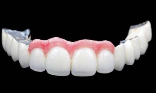 福州登特口腔:价格亲民,技术精湛,服务周到(图1)