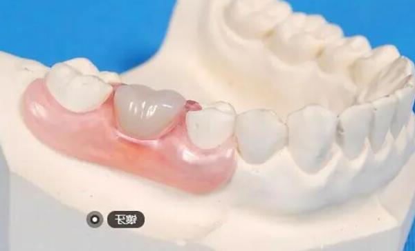 南京口腔医院种植牙服务排行榜，十大顶尖牙科机构推荐