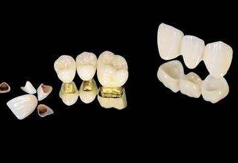 兰州种植牙技术哪家强?口腔医院排名大揭秘(图1)